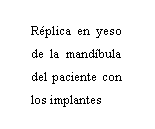 Cuadro de texto: Rplica en yeso de la mandbula del paciente con los implantes