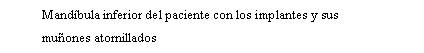 Cuadro de texto: Mandbula inferior del paciente con los implantes y sus muones atornillados