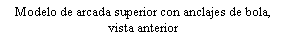 Cuadro de texto: Modelo de arcada superior con anclajes de bola, vista anterior