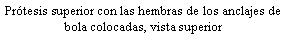 Cuadro de texto: Prtesis superior con las hembras de los anclajes de bola colocadas, vista superior